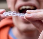 מהר יותר, מביך פחות: יישור שיניים נסתר למבוגרים-תמונה